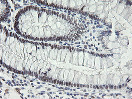 TLE1 Antibody in Immunohistochemistry (Paraffin) (IHC (P))