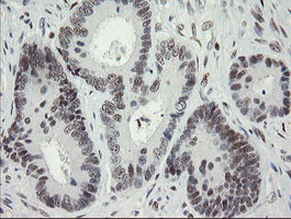 TLE1 Antibody in Immunohistochemistry (Paraffin) (IHC (P))