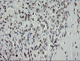 TLE1 Antibody in Immunohistochemistry (Paraffin) (IHC (P))