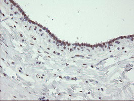 TLE1 Antibody in Immunohistochemistry (Paraffin) (IHC (P))