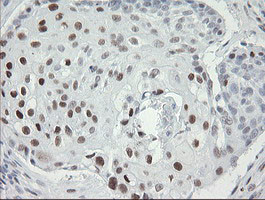 TLE1 Antibody in Immunohistochemistry (Paraffin) (IHC (P))