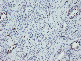 TLE1 Antibody in Immunohistochemistry (Paraffin) (IHC (P))