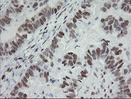 TLE1 Antibody in Immunohistochemistry (Paraffin) (IHC (P))