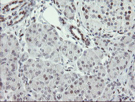 TLE1 Antibody in Immunohistochemistry (Paraffin) (IHC (P))