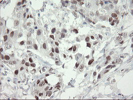 TLE1 Antibody in Immunohistochemistry (Paraffin) (IHC (P))