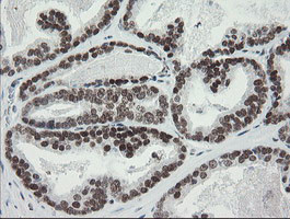 TLE1 Antibody in Immunohistochemistry (Paraffin) (IHC (P))