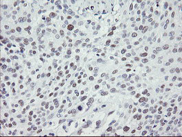 TLE1 Antibody in Immunohistochemistry (Paraffin) (IHC (P))