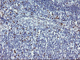 TLE1 Antibody in Immunohistochemistry (Paraffin) (IHC (P))