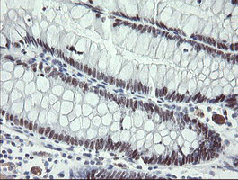 TLE1 Antibody in Immunohistochemistry (Paraffin) (IHC (P))