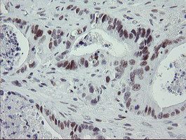 TLE1 Antibody in Immunohistochemistry (Paraffin) (IHC (P))