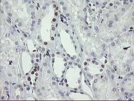 TLE1 Antibody in Immunohistochemistry (Paraffin) (IHC (P))