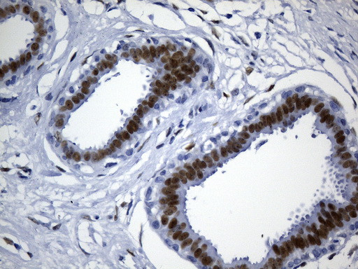 TLE1 Antibody in Immunohistochemistry (Paraffin) (IHC (P))