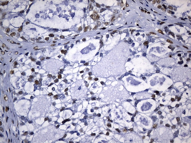 TLE1 Antibody in Immunohistochemistry (Paraffin) (IHC (P))