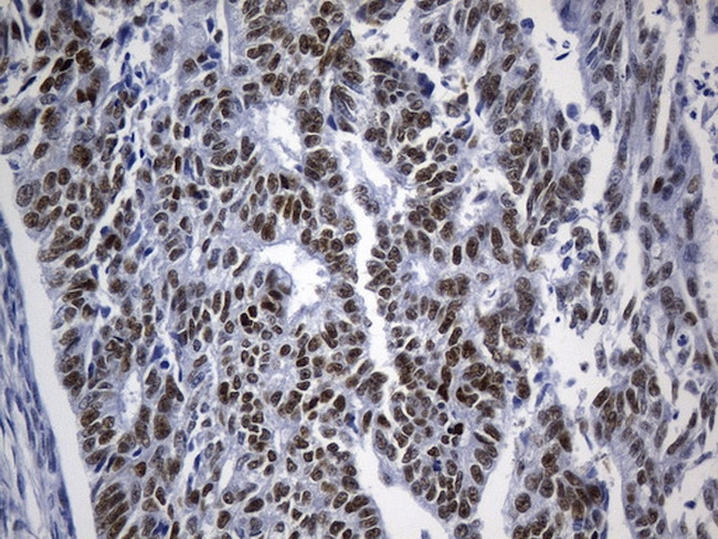 TLE1 Antibody in Immunohistochemistry (Paraffin) (IHC (P))