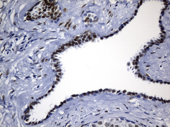 TLE1 Antibody in Immunohistochemistry (Paraffin) (IHC (P))