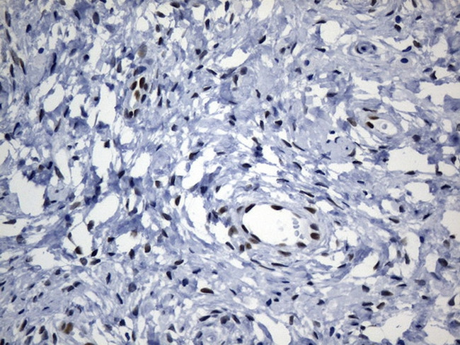 TLE1 Antibody in Immunohistochemistry (Paraffin) (IHC (P))