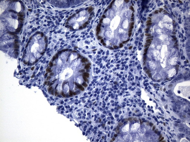 TLE1 Antibody in Immunohistochemistry (Paraffin) (IHC (P))