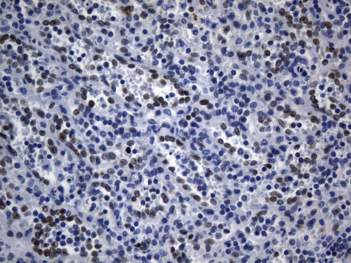 TLE1 Antibody in Immunohistochemistry (Paraffin) (IHC (P))