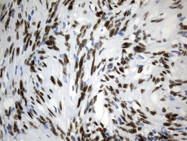 TLE1 Antibody in Immunohistochemistry (Paraffin) (IHC (P))