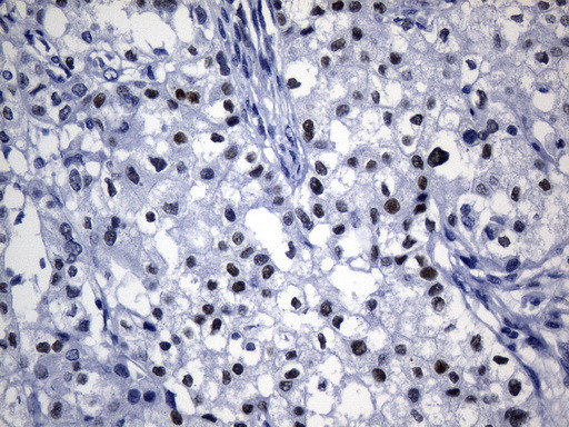 TLE1 Antibody in Immunohistochemistry (Paraffin) (IHC (P))