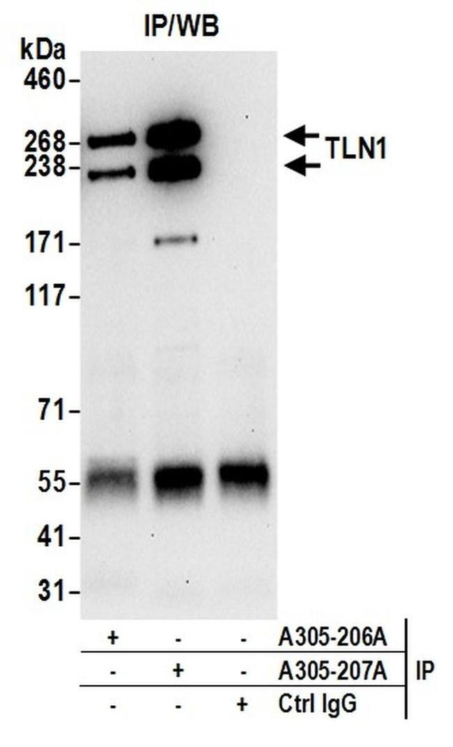 TLN1/Talin-1 Antibody in Western Blot (WB)