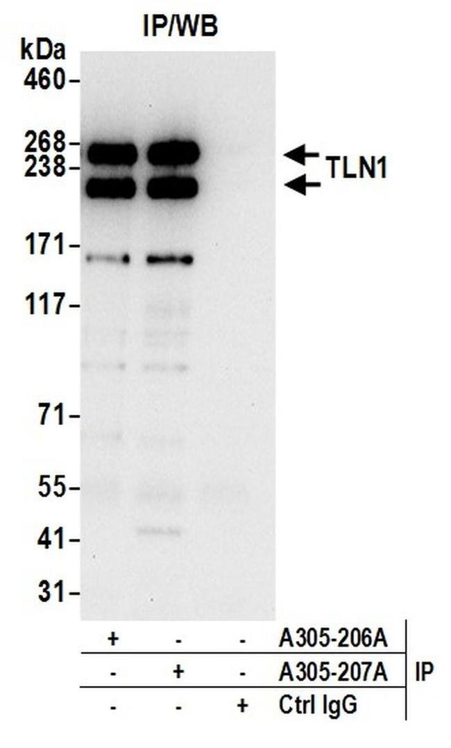 TLN1/Talin-1 Antibody in Western Blot (WB)