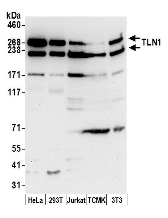 TLN1/Talin-1 Antibody in Western Blot (WB)