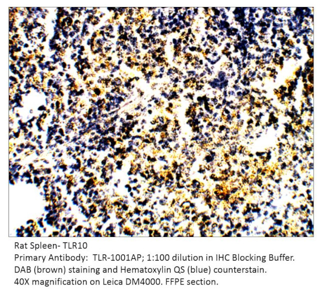 TLR10 Antibody in Immunohistochemistry (IHC)