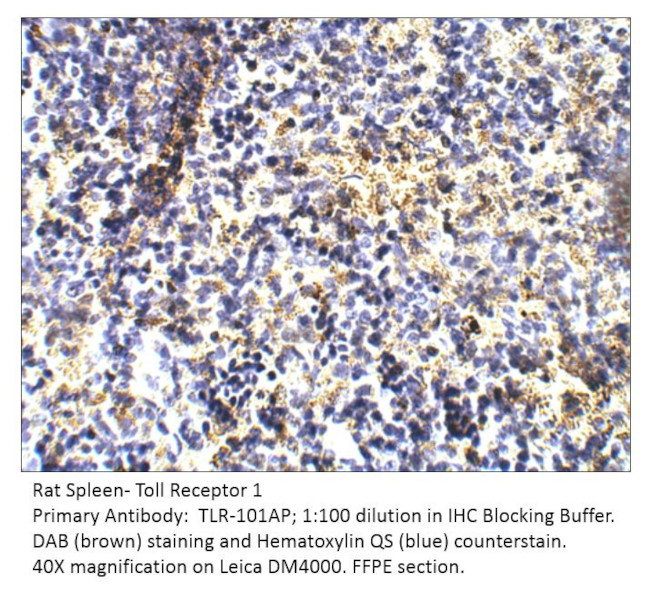 TLR1 Antibody in Immunohistochemistry (IHC)