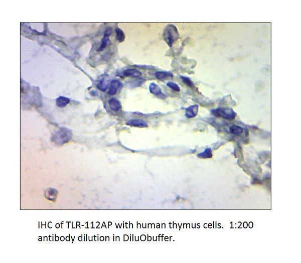 TLR1 Antibody in Immunohistochemistry (IHC)