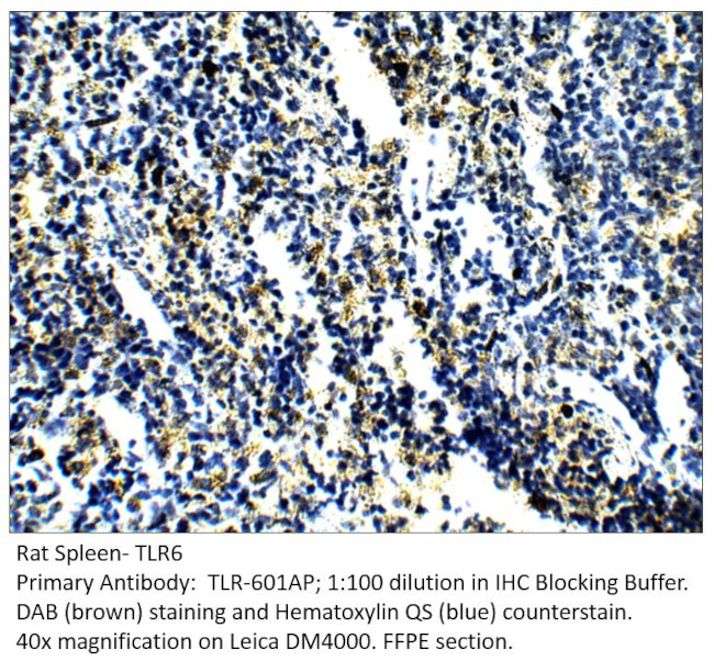 TLR6 Antibody in Immunohistochemistry (IHC)