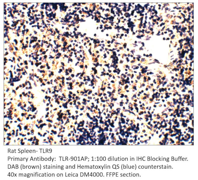 TLR9 Antibody in Immunohistochemistry (IHC)