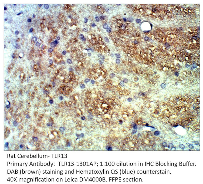 TLR13 Antibody in Immunohistochemistry (IHC)