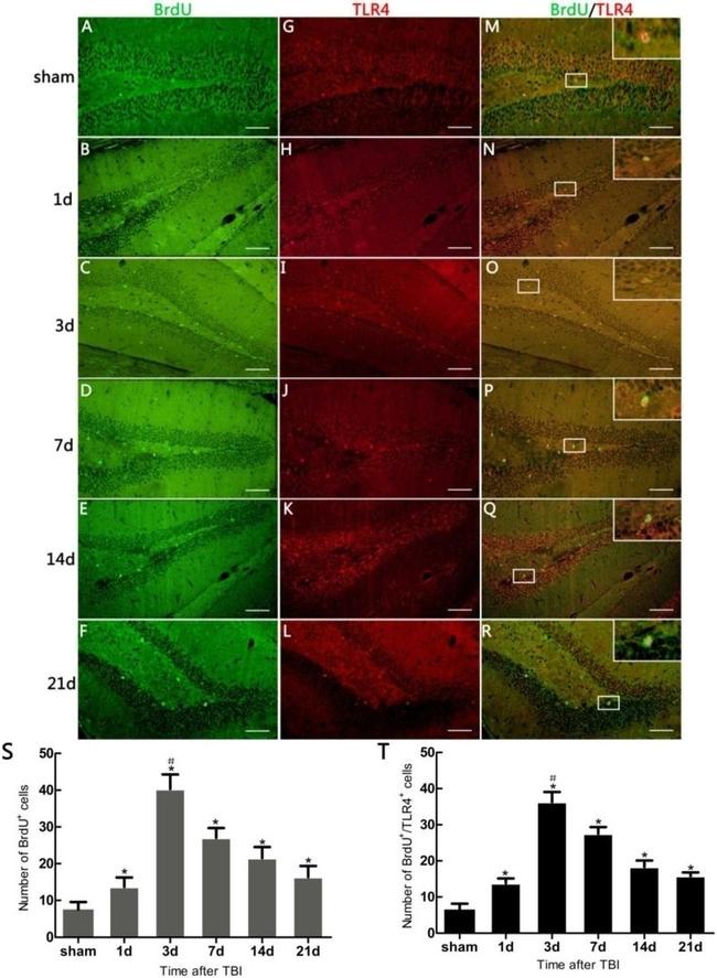 TLR4 Antibody in Immunohistochemistry (Paraffin) (IHC (P))