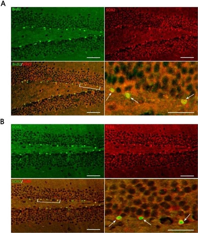 TLR4 Antibody in Immunohistochemistry (Paraffin) (IHC (P))