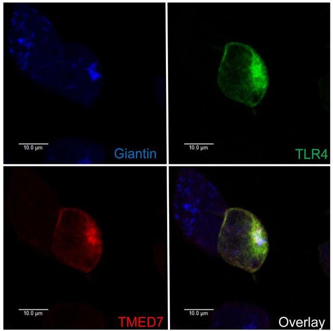 CD284 (TLR4) Antibody in Immunocytochemistry (ICC/IF)