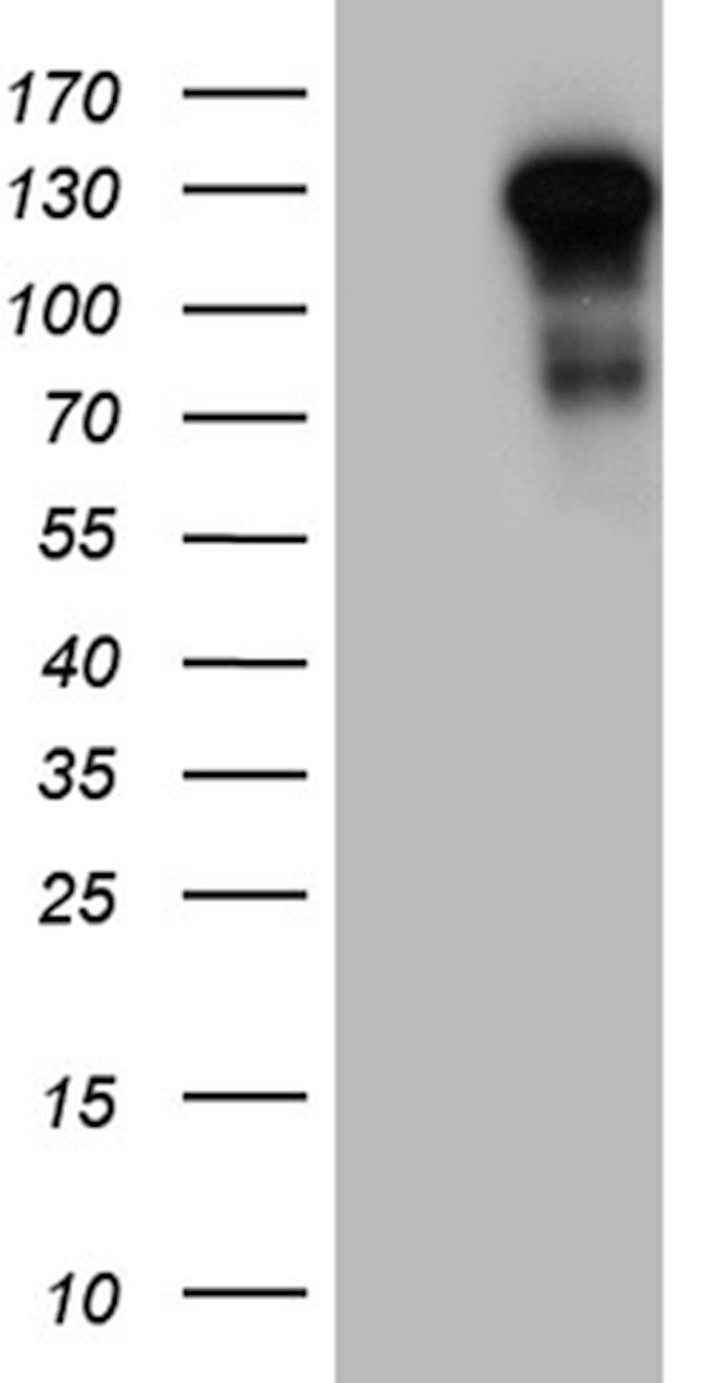 TLR8 Antibody in Western Blot (WB)