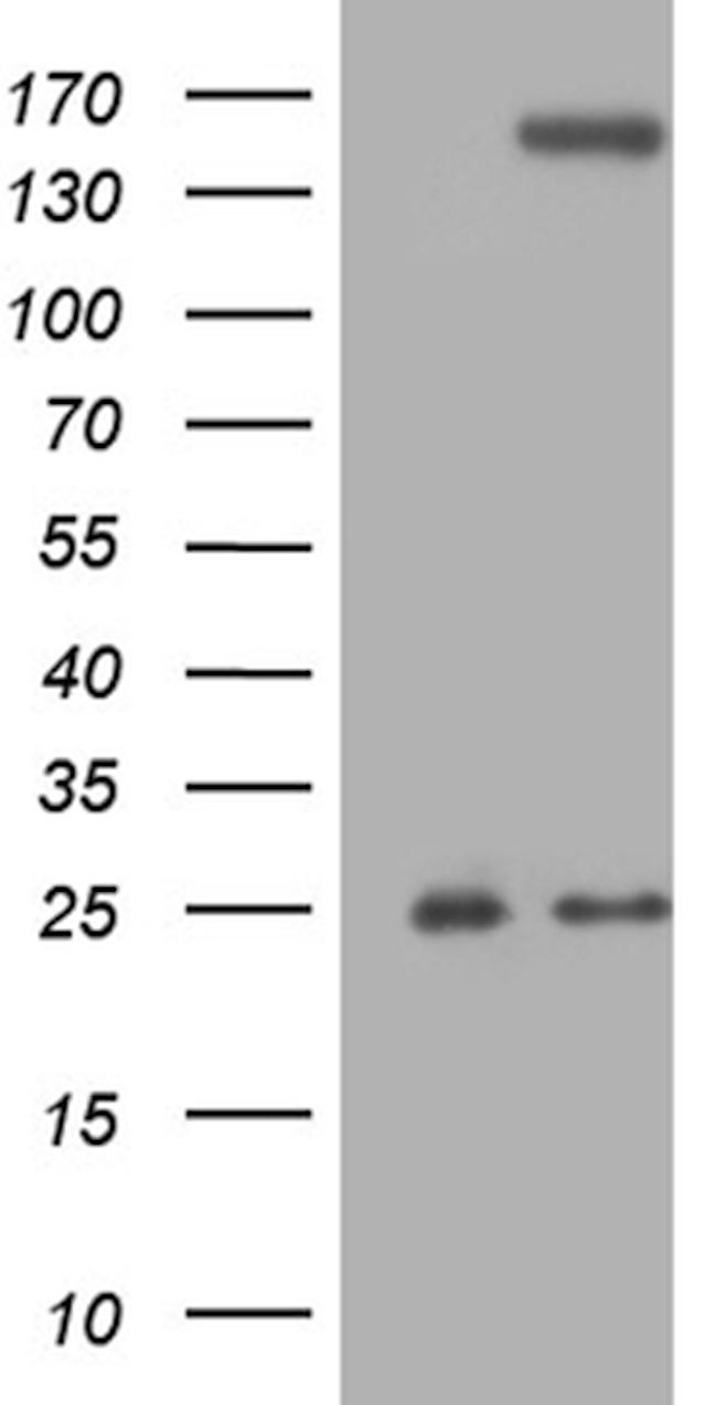 TLR8 Antibody in Western Blot (WB)