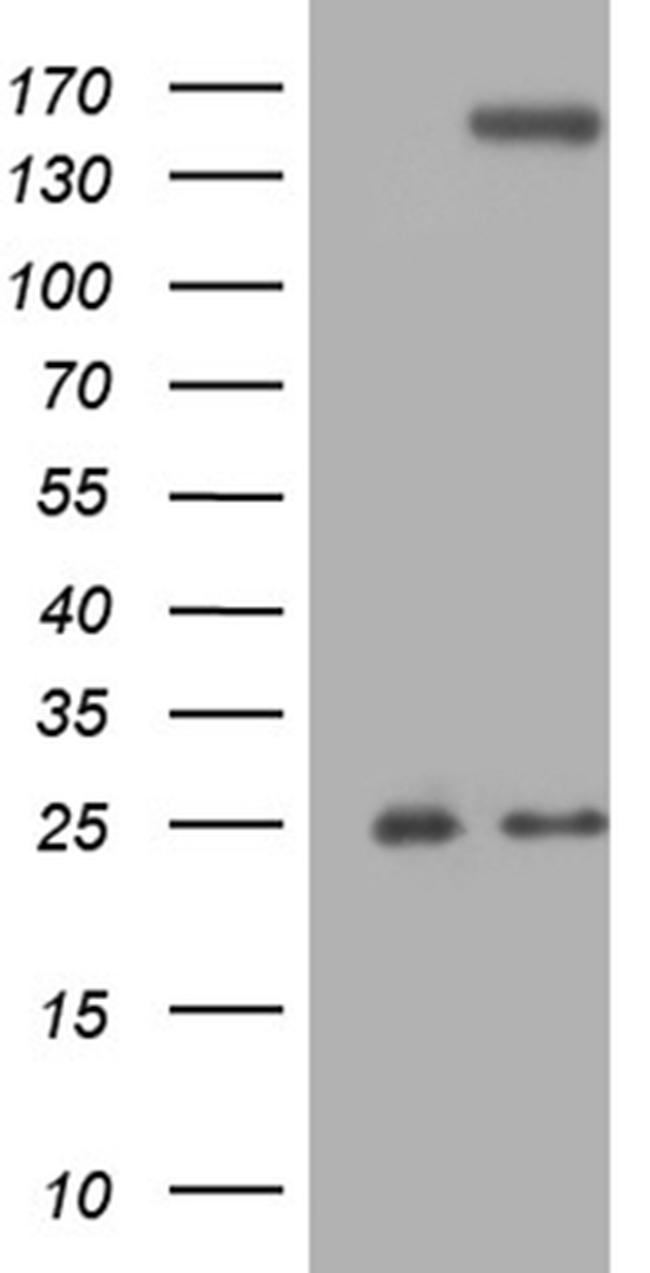 TLR8 Antibody in Western Blot (WB)