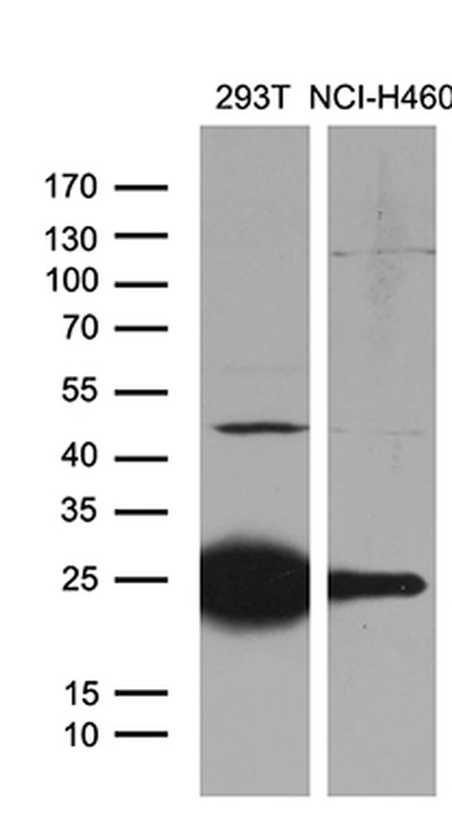 TLR8 Antibody in Western Blot (WB)