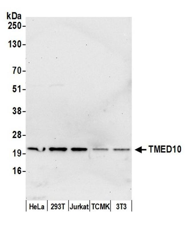 TMED10/TMP21 Antibody in Western Blot (WB)