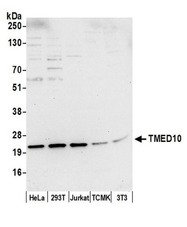 TMED10/TMP21 Antibody in Western Blot (WB)