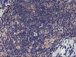 TMEFF2 Antibody in Immunohistochemistry (Paraffin) (IHC (P))