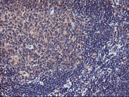 TMEFF2 Antibody in Immunohistochemistry (Paraffin) (IHC (P))