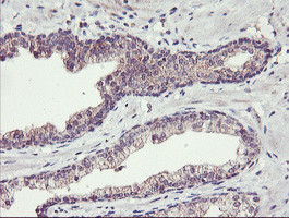 TMEFF2 Antibody in Immunohistochemistry (Paraffin) (IHC (P))