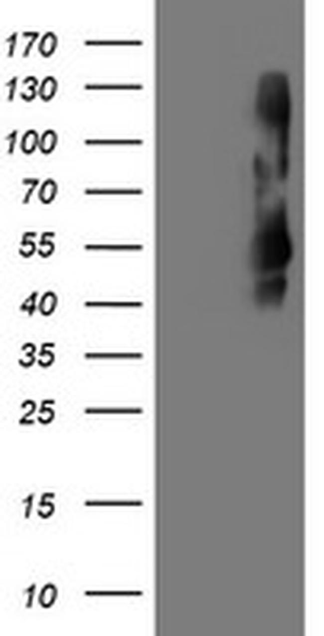 TMEFF2 Antibody in Western Blot (WB)