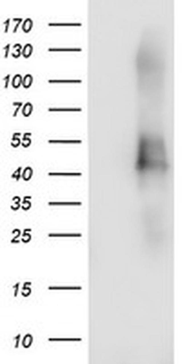 TMEFF2 Antibody in Western Blot (WB)