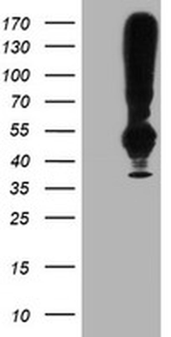 TMEFF2 Antibody in Western Blot (WB)