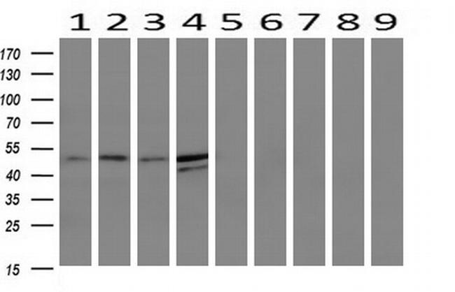 TMEFF2 Antibody in Western Blot (WB)