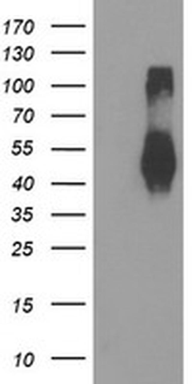 TMEFF2 Antibody in Western Blot (WB)